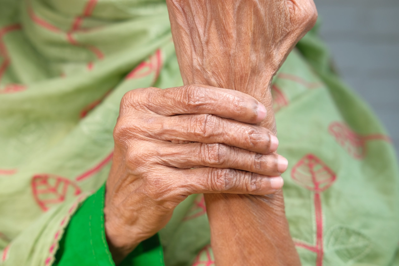 Artrite alle mani: come una dieta ricca di antiossidanti può alleviare il dolore Artrite alle mani: come una dieta ricca di antiossidanti può alleviare il dolore