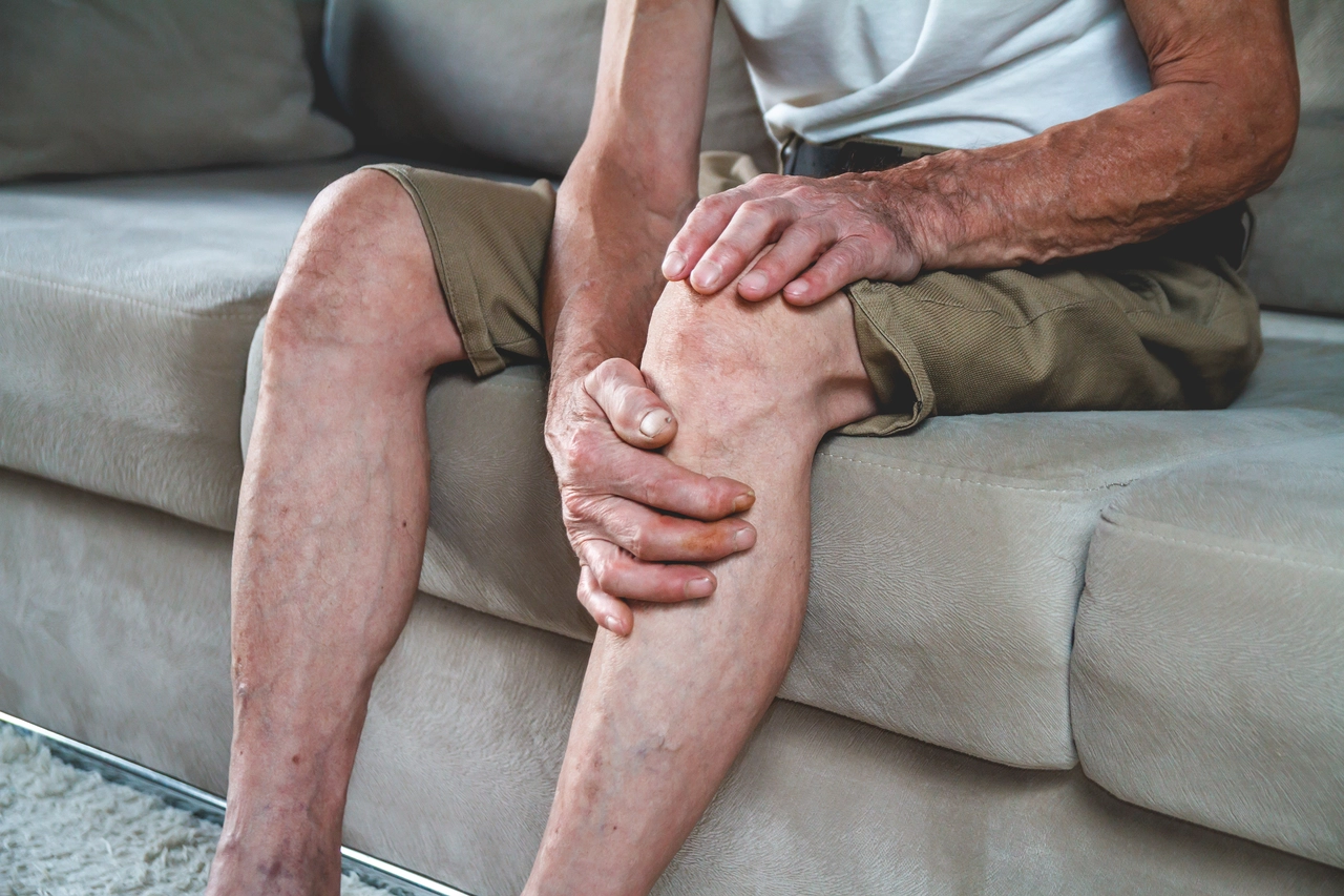 Artrite alle mani: come una dieta ricca di antiossidanti può alleviare il dolore Artrite alle mani: come una dieta ricca di antiossidanti può alleviare il dolore
