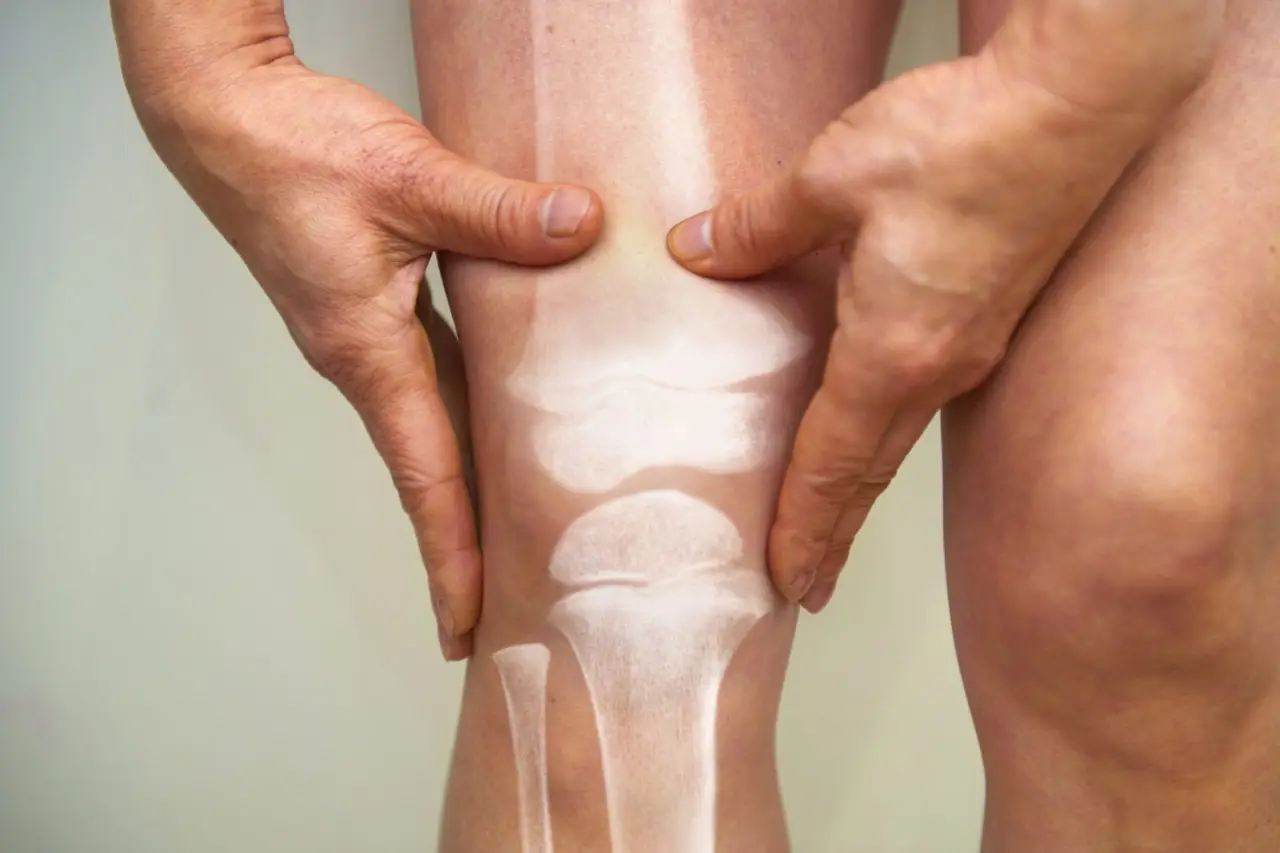 Azione rapida: rimedi naturali da introdurre subito nella dieta per articolazioni più leggere Azione rapida: rimedi naturali da introdurre subito nella dieta per articolazioni più leggere