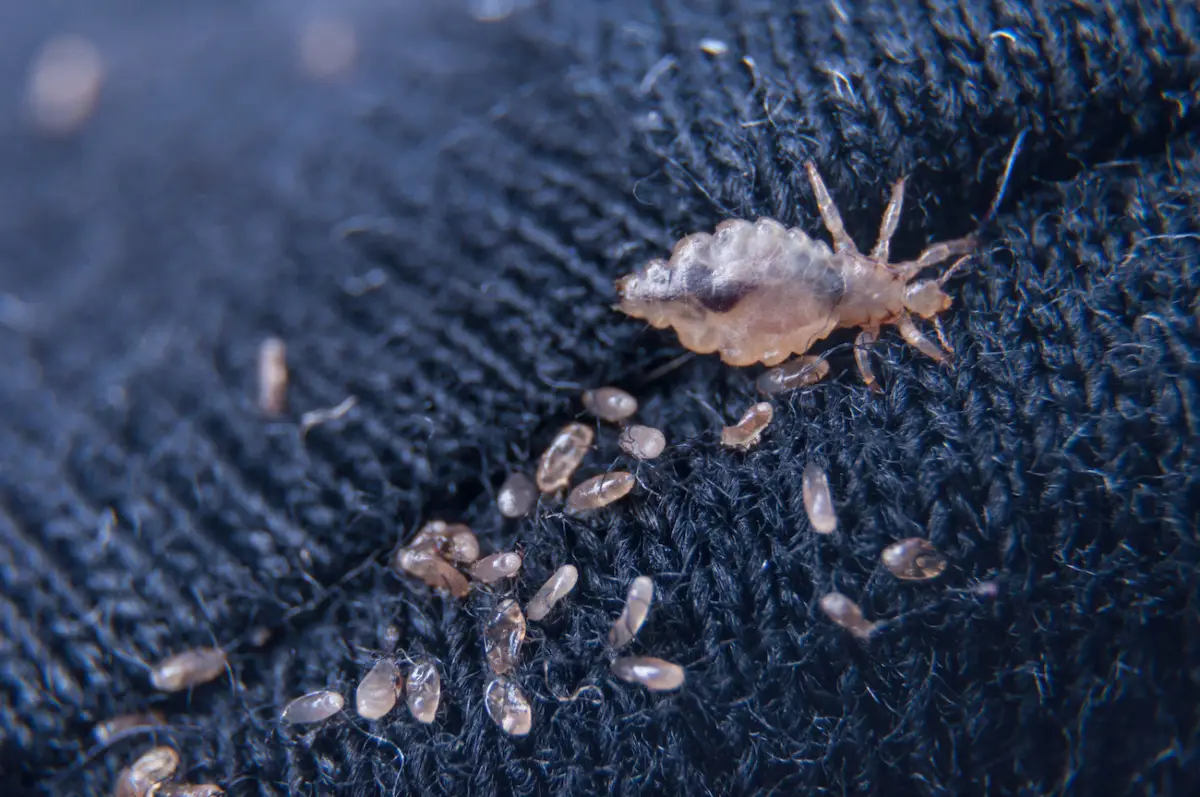 Peli di animale sul divano: il metodo diretto per eliminarli usando un oggetto comune Peli di animale sul divano: il metodo diretto per eliminarli usando un oggetto comune