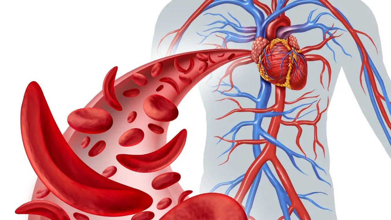 Scopri subito i sintomi dell'anemia e come intervenire tempestivamente a casa Scopri subito i sintomi dell'anemia e come intervenire tempestivamente a casa
